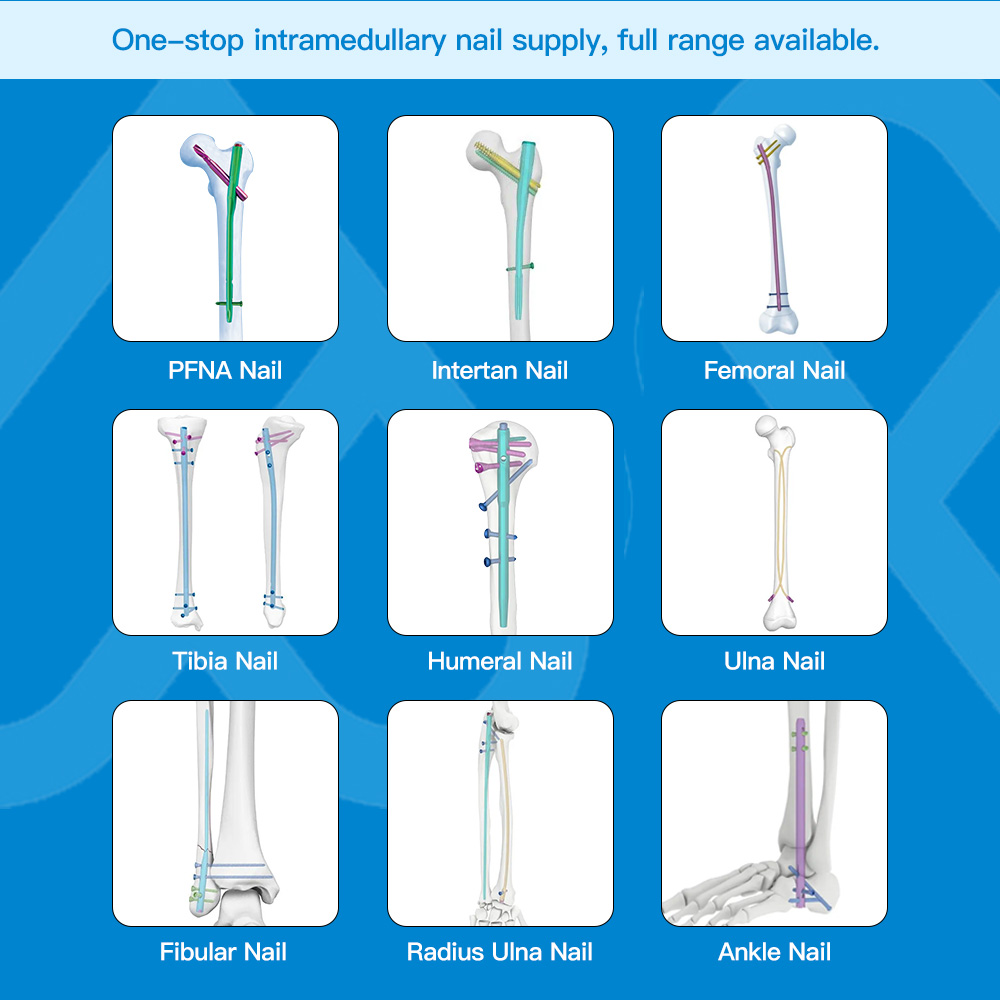 Intramedullary nail system.jpg