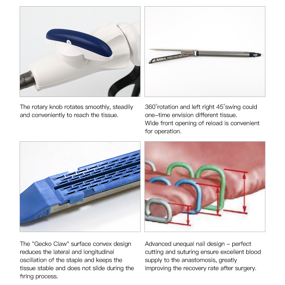 endo stapler linear7.jpg