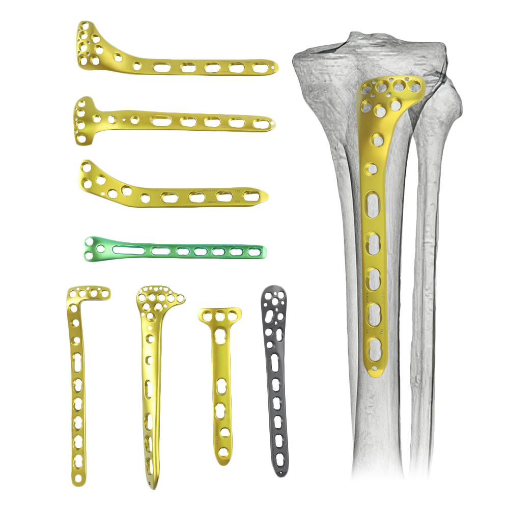 Tibia Locking Plate Set
