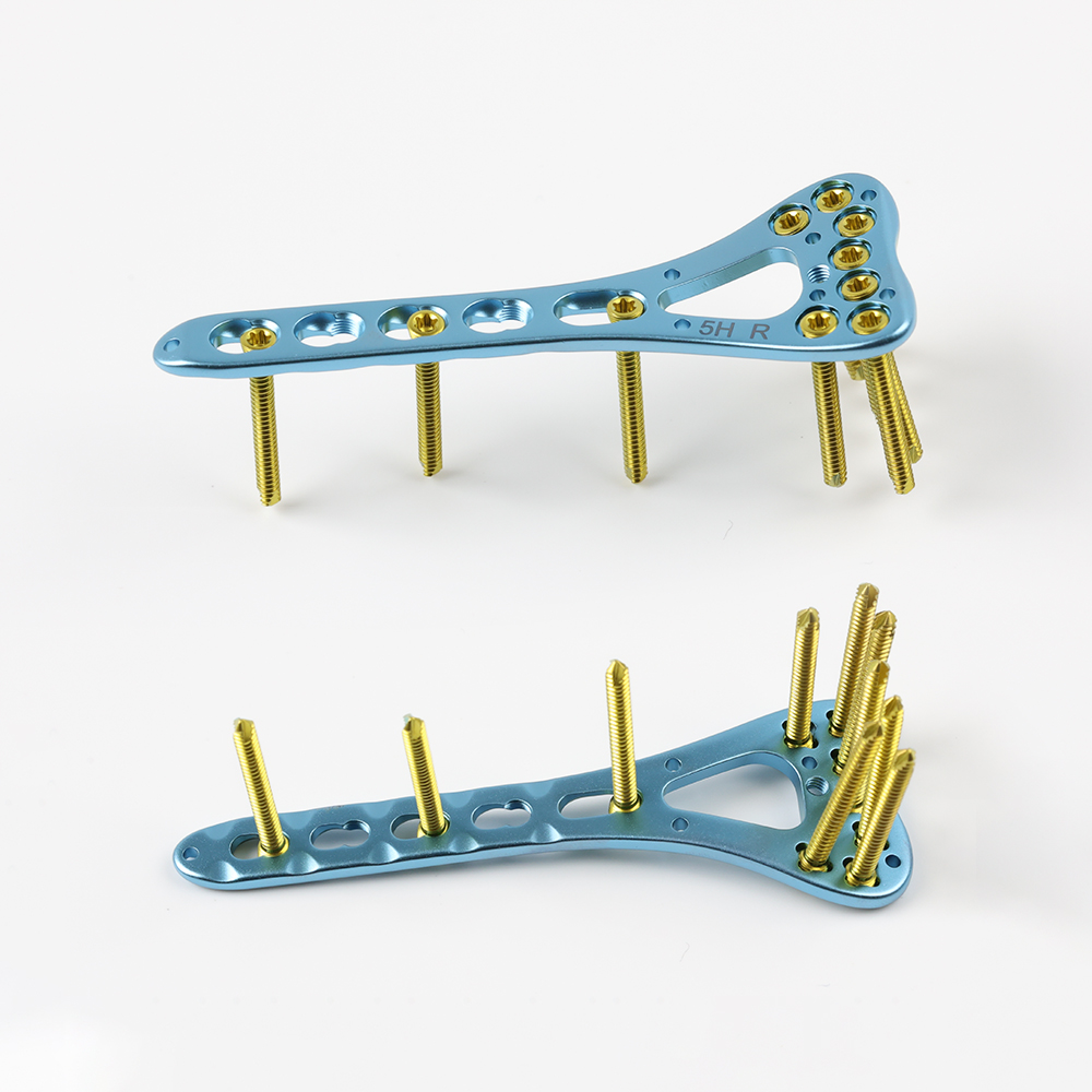 Radius Locking Plate Set