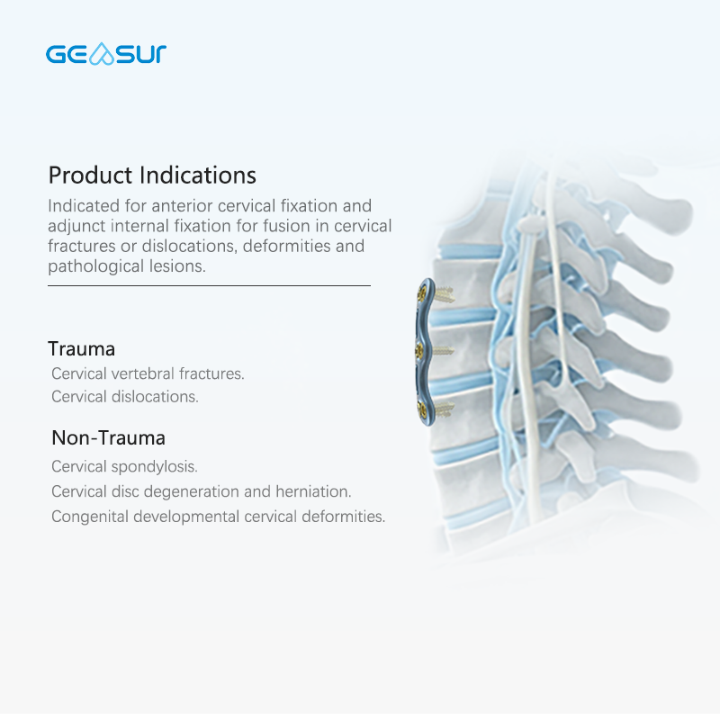 Anterior cervical plate