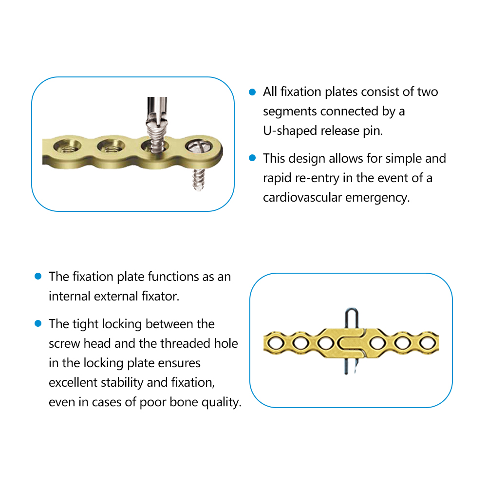 Sternal Fixation System