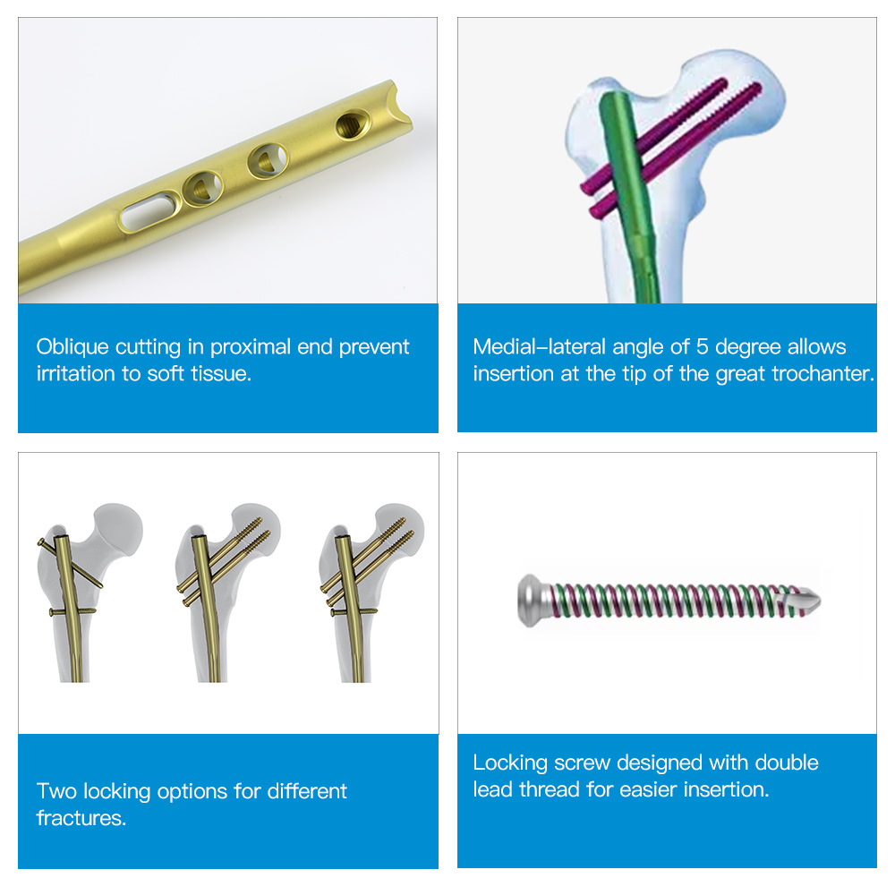 Femoral Expert Intramedullary Nail