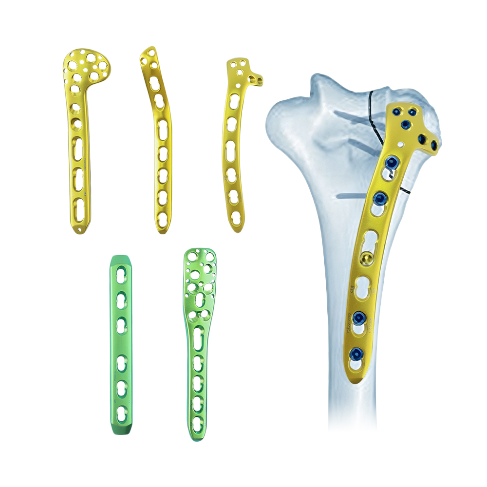 Humerus Locking Plate Set