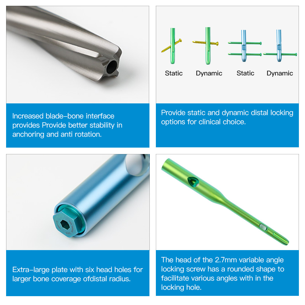 PFNA Intramedullary Nail System