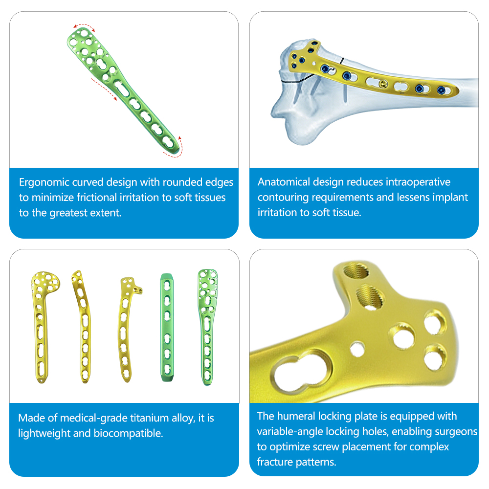 Humerus Locking Plate Set