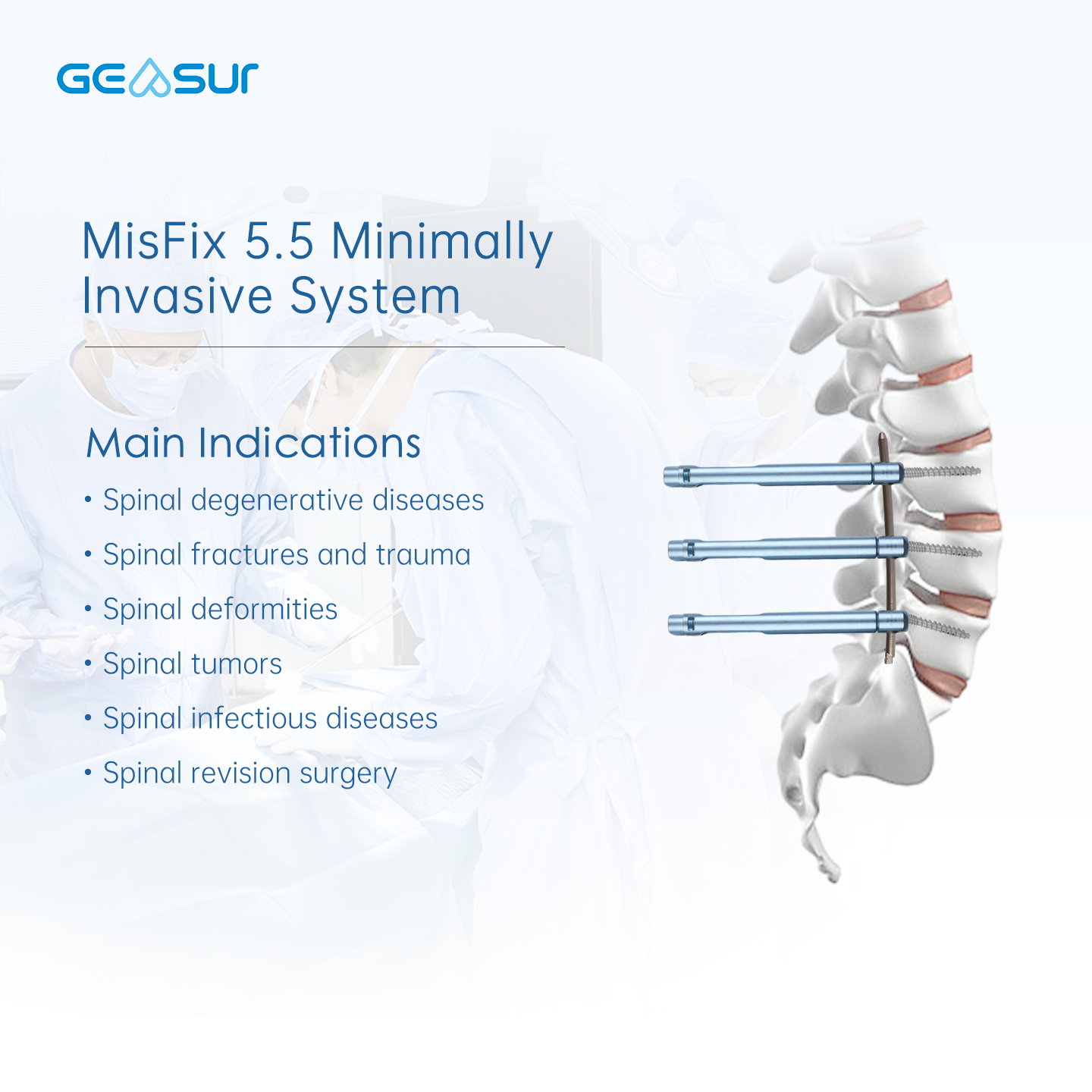 5.5 Mis Pedicle Screw System