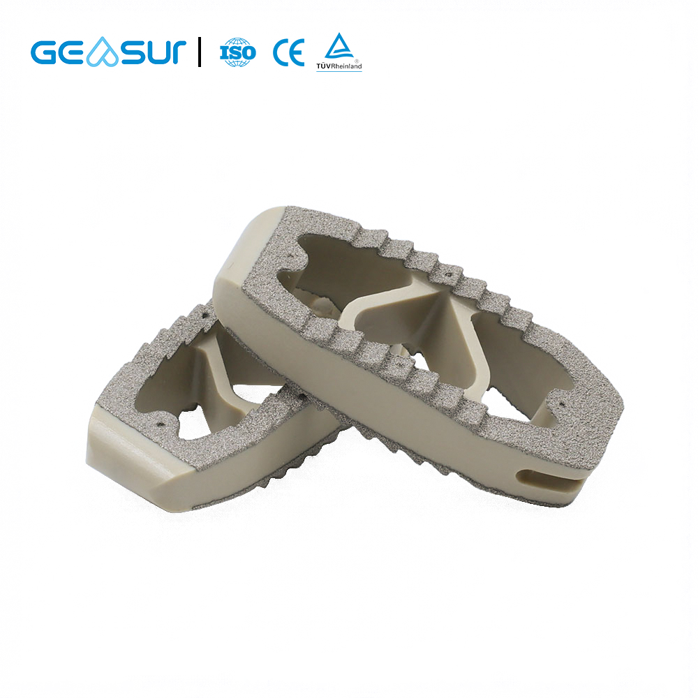  Titanium Coating OLIF Fusion Cage