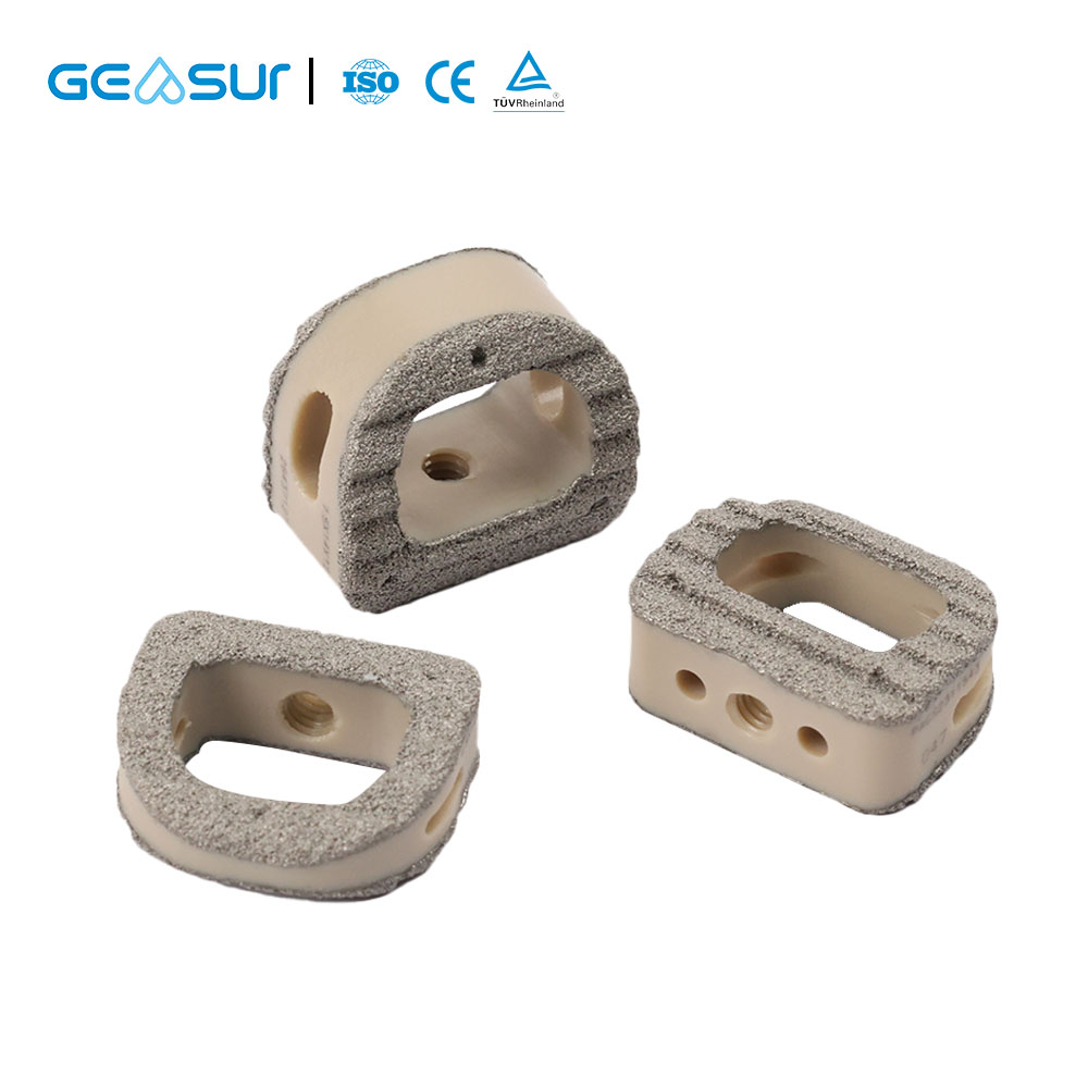 Titanium Coating Cervical Cage