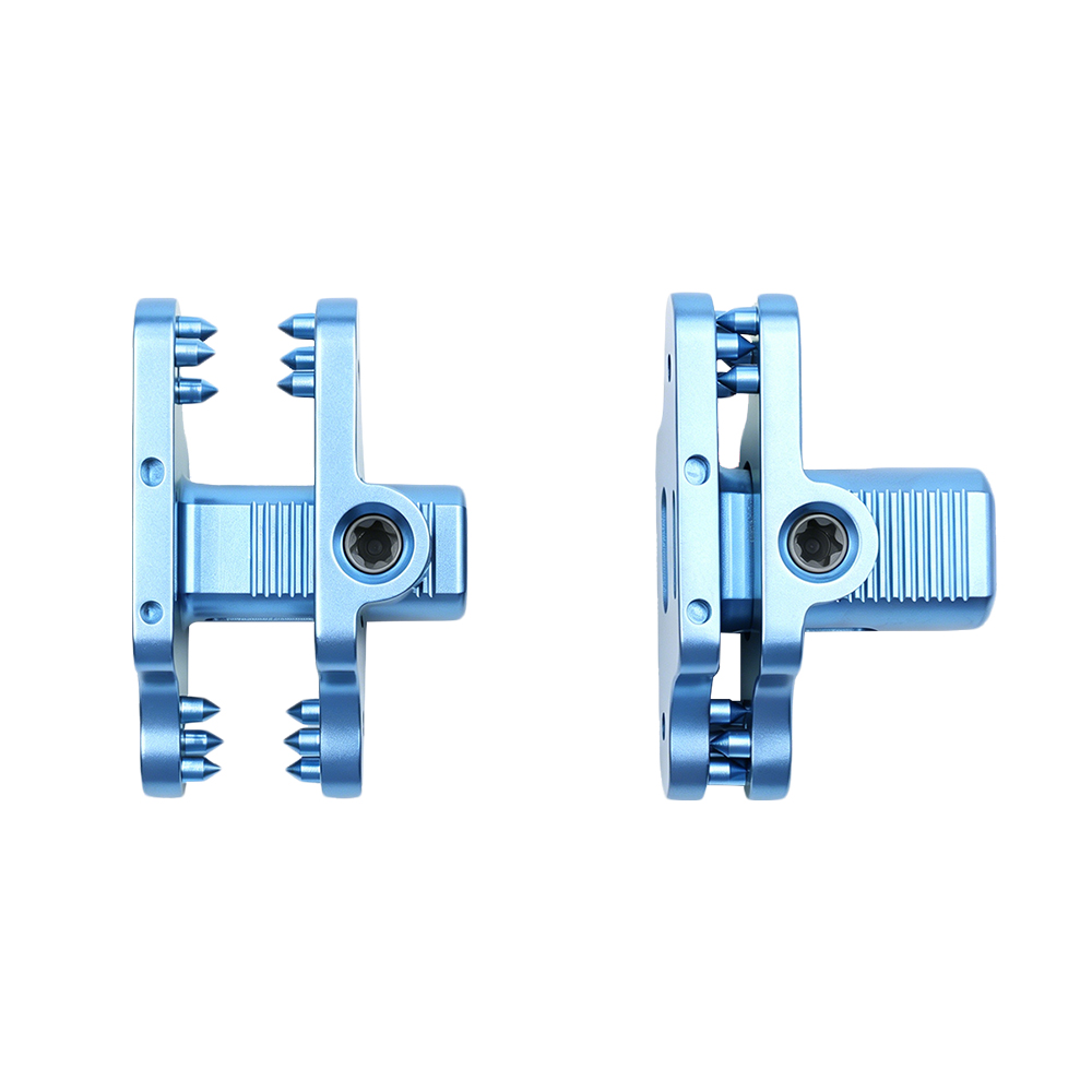 Interspinous Fixation System