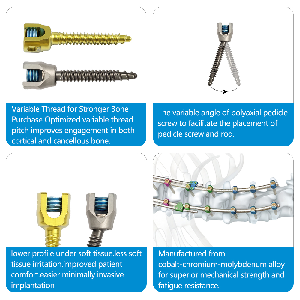 4.5 Plus CoCrMo Spinal Fixation System