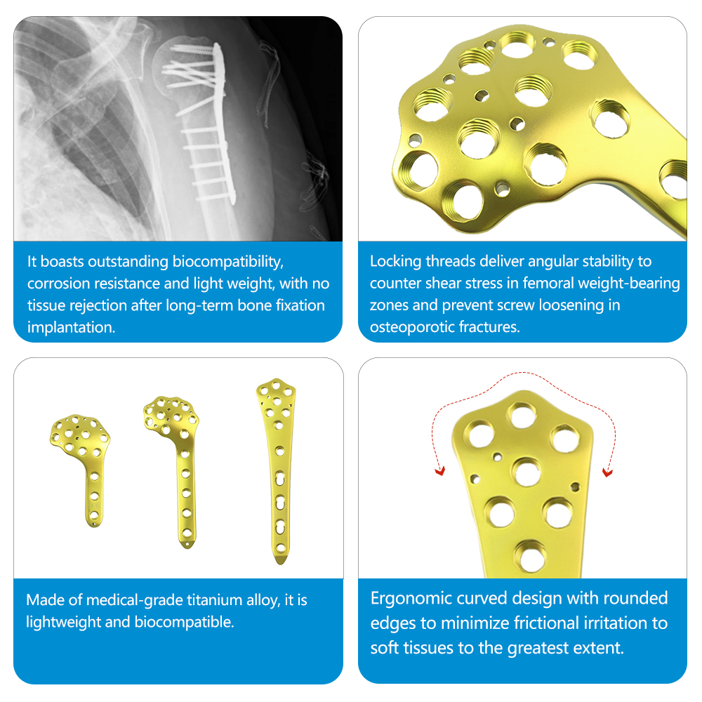 Femoral Locking Plate Set