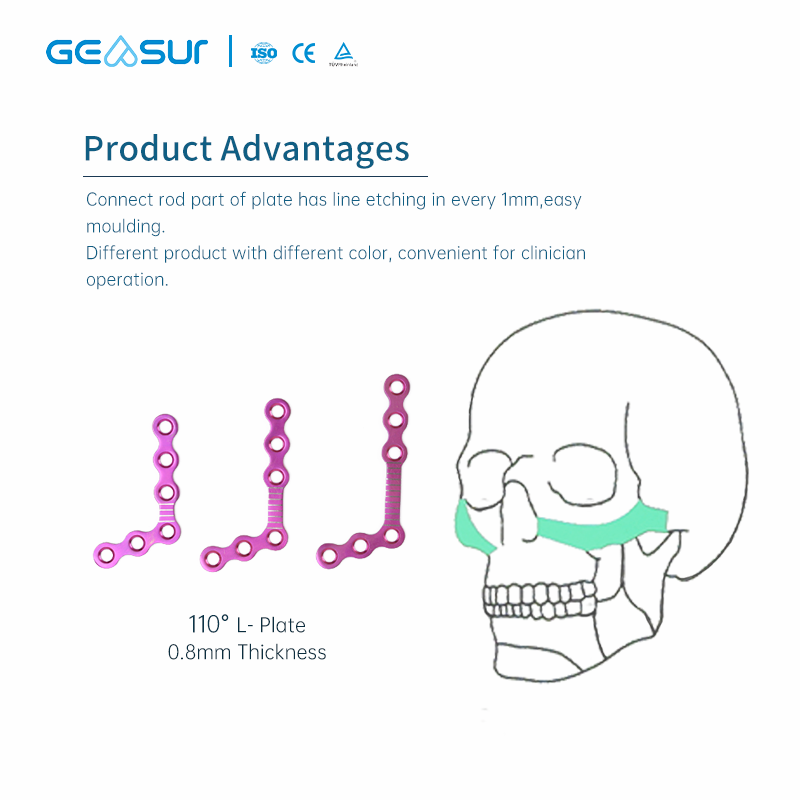 2.0 & 0.8 Maxillofacial Mini Plate Set
