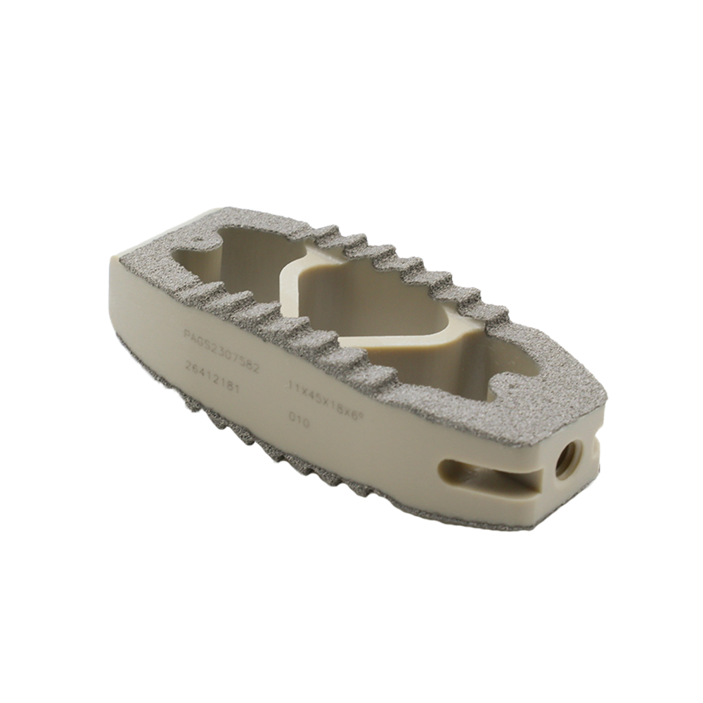  Titanium Coating OLIF Fusion Cage