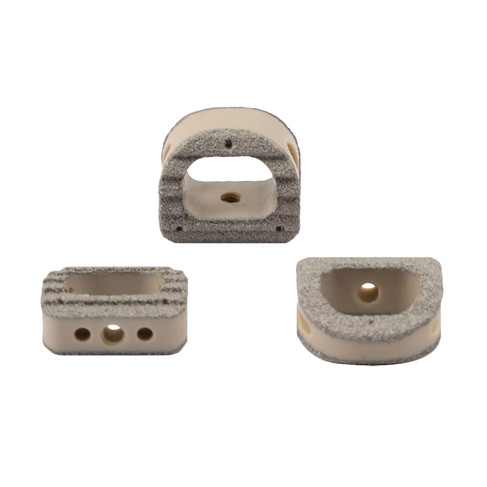 Titanium Coating Cervical Cage