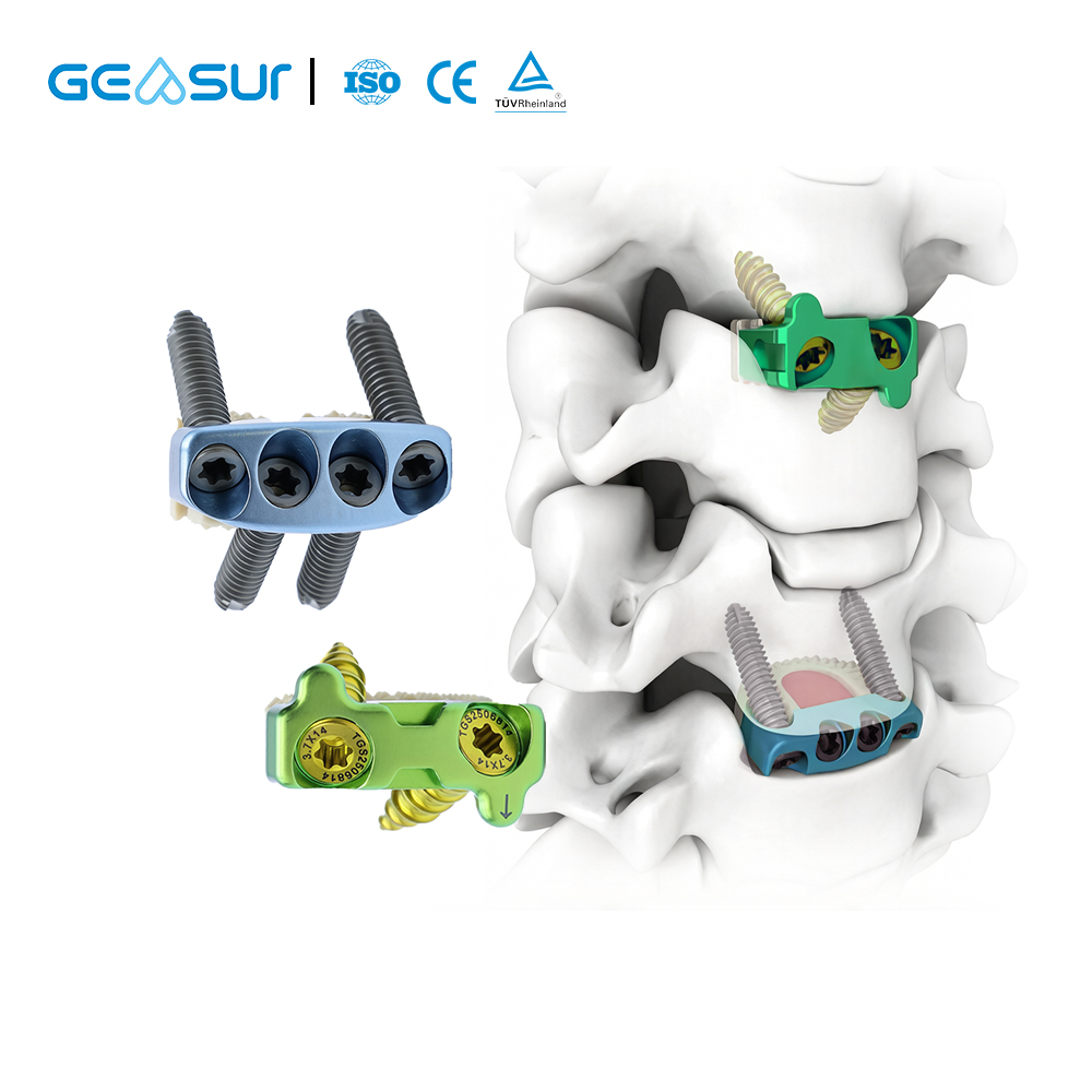 Zero-profile cervical fusion cage2