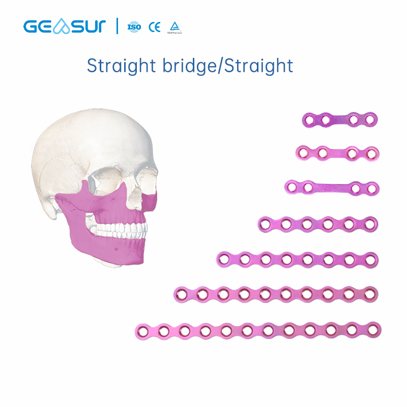 2.0 & 0.8 Maxillofacial Mini Plate Set