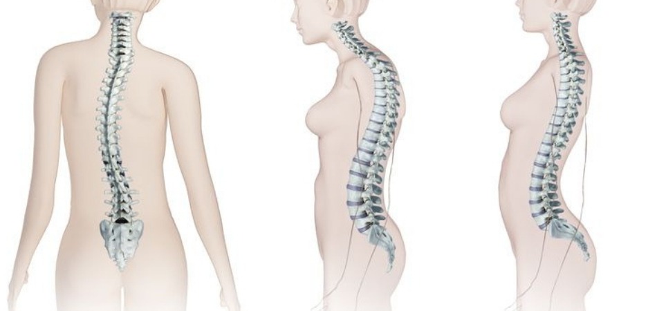 Spinal Deformity