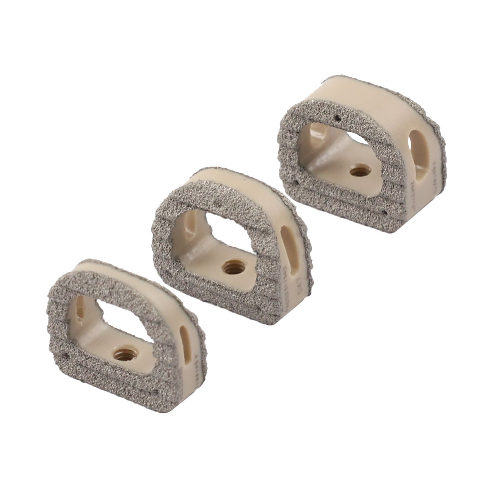 Titanium Coating Cervical Cage