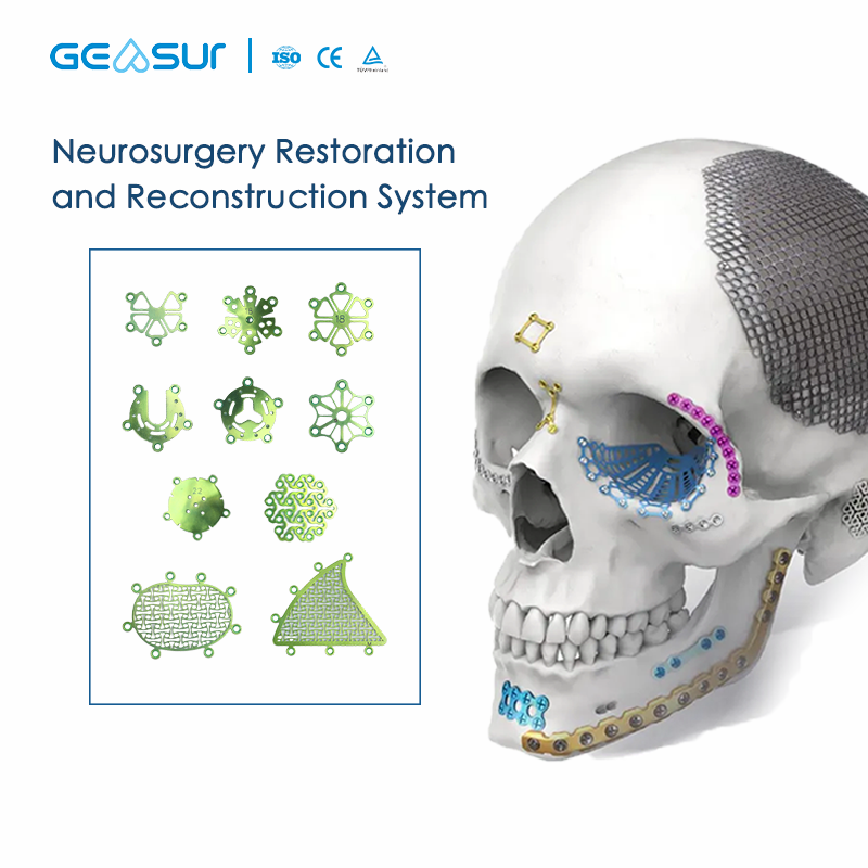 Cranial Fixation System