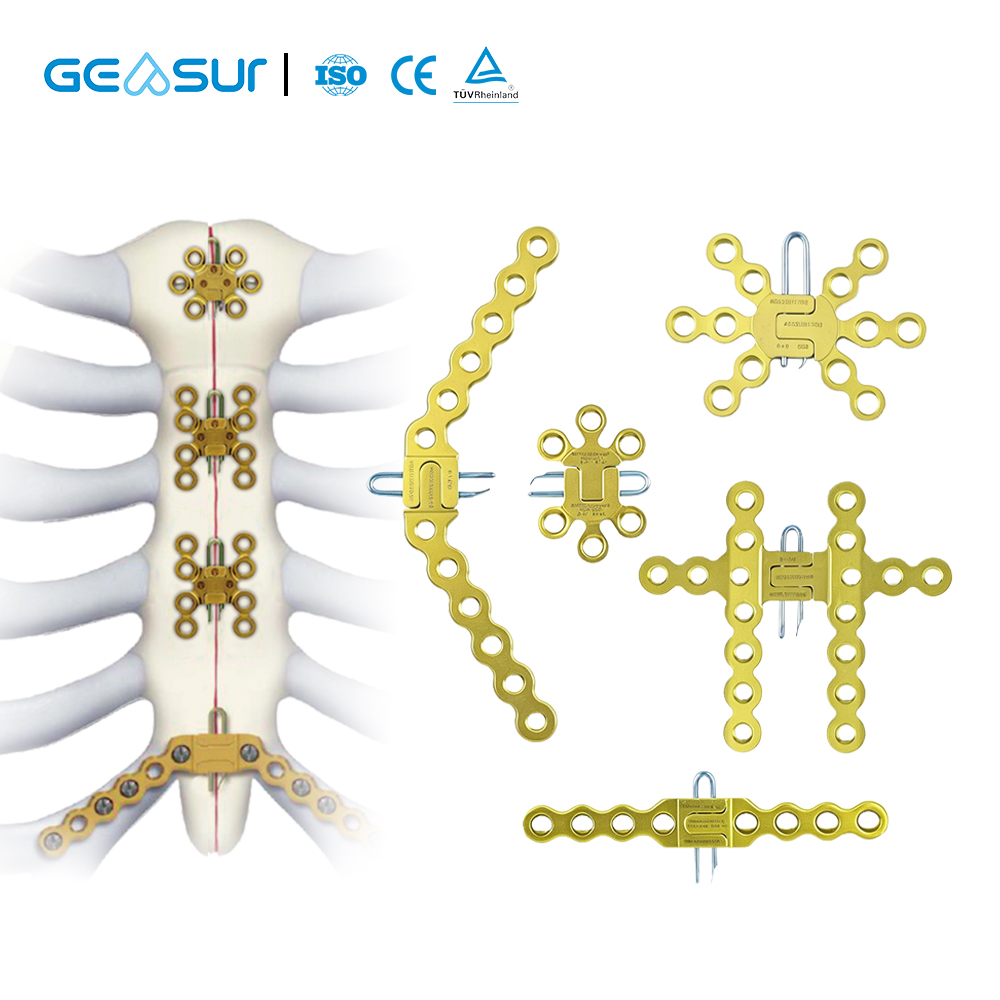Sternal Fixation System