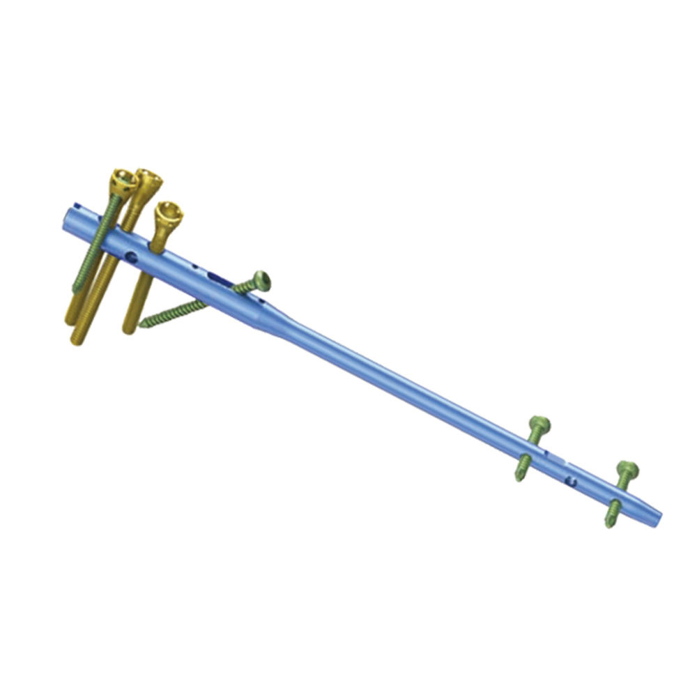 Humeral Intramedullary Nail