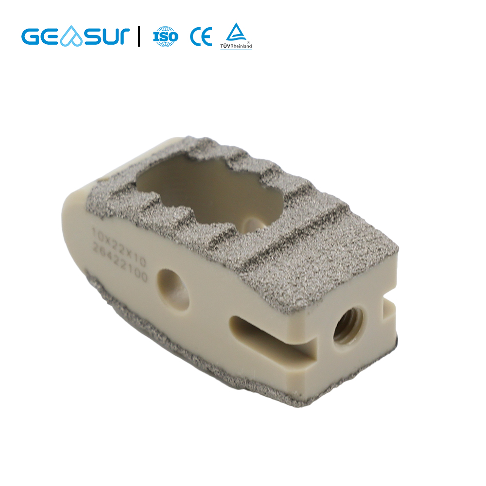 Titanium Coating Fusion PLIF Cage