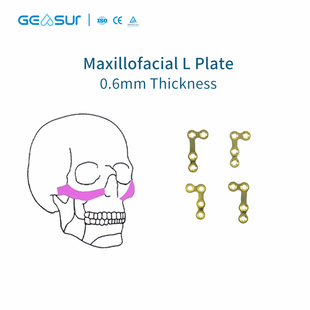 1.5 & 0.6 Maxillofacial micro plate set 